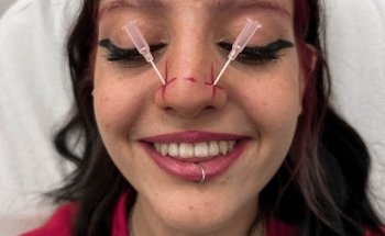 The Santos Mafia Tattoo - Piercing - Laser